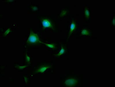 Polyclonal Rabbit anti-Human SYN / FYN Antibody (IHC)