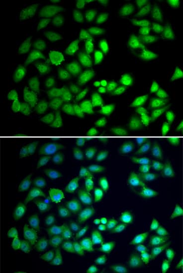 Polyclonal Rabbit anti-Human WDR77 / MEP50 Antibody (IHC, IF, WB)