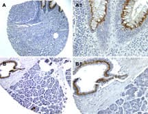 Polyclonal Rabbit anti-Human NOD1 Antibody (aa494-512, IHC, WB)