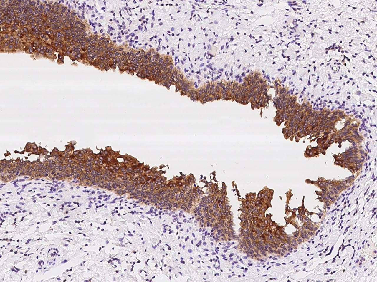 SPINK1 Antibody