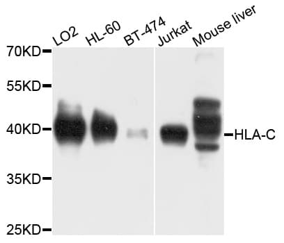 HLA-C Antibody