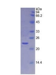 Mouse TIMP4 Protein (Recombinant His)