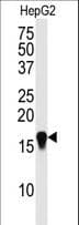 Polyclonal Rabbit anti-Human SUMO4 Antibody (aa34-63, IHC, WB)