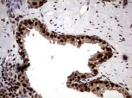 Monoclonal Mouse anti-Human NBN / Nibrin Antibody (clone OTI8E7, IHC, WB)