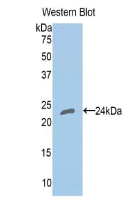 HLA-DRA Antibody (aa25-216)