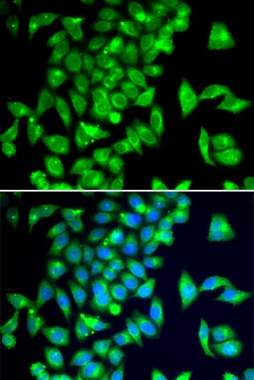 TPH2 Antibody