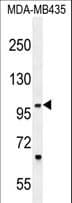 ZNF512B Antibody (aa826-855)