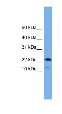 PS20 / WFDC1 Antibody (aa35-84)