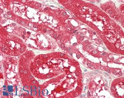 IHC-plus™ HMT / HNMT Antibody