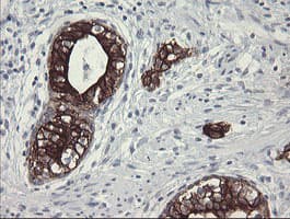 SLA2 / SLAP2 Antibody (clone OTI3A7)