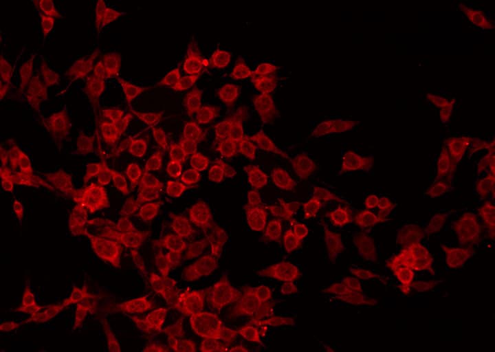 TGM2 / Transglutaminase 2 Antibody