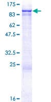 Human HCCS1 / VPS53 Protein (Recombinant GST)