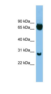 Polyclonal Rabbit anti-Human SOX13 Antibody (C-Terminus, WB)