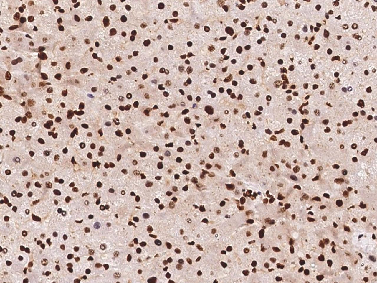 Polyclonal Rabbit anti-Human HNRNPC / HNRNP C Antibody (IHC, IF, WB)