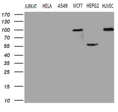 Monoclonal Mouse anti-Human TGM2 / Transglutaminase 2 Antibody (clone OTI1A3, IHC, WB)