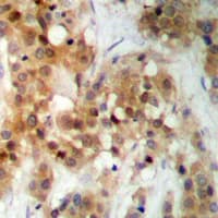 CSNK2A1 Antibody (Internal)