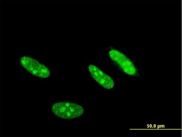 CSNK2A2 Antibody (clone 4F2)