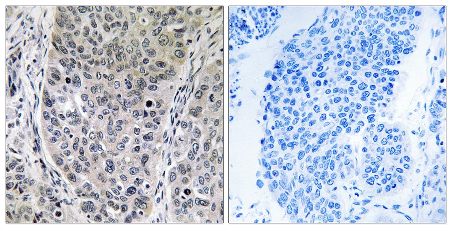 HGH1 / FAM203A Antibody