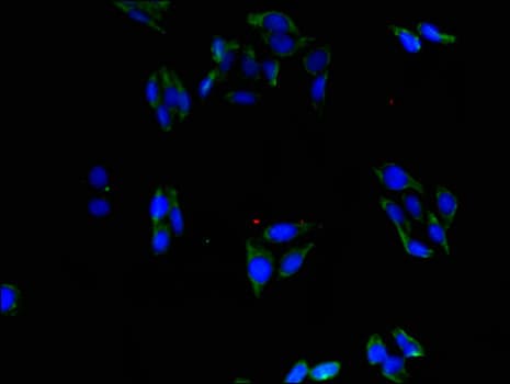 Polyclonal Rabbit anti-Human ABLIM1 Antibody (IHC, IF, WB)
