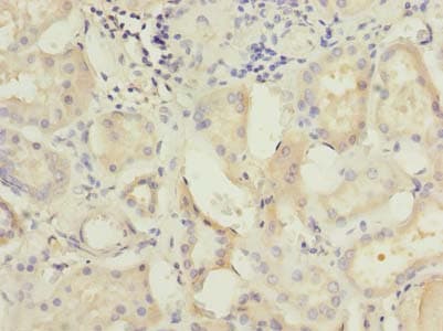 C5orf22 Antibody