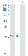 HSPB1 / HSP27 Antibody (clone 3G3)