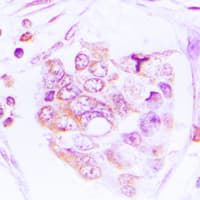 Polyclonal Rabbit anti-Human RPS6KB1 / P70S6K / S6K Antibody (phospho-Thr412, IHC, IF, WB)