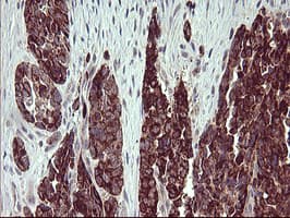 ARG2 / Arginase 2 Antibody (clone 3G5, Carrier-free)
