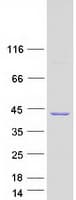 Human GMPR2 Protein (Recombinant Myc-DDK (Flag))