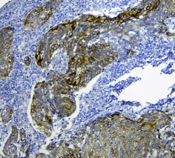 SLC34A2 / NaPi-2b Antibody
