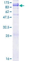 Human ADAM21 Protein (Recombinant GST)