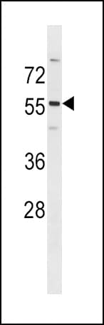 PDK2 Antibody (aa378-407)