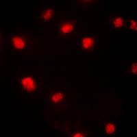 CDKN1A / WAF1 / p21 Antibody (phospho-Thr145)