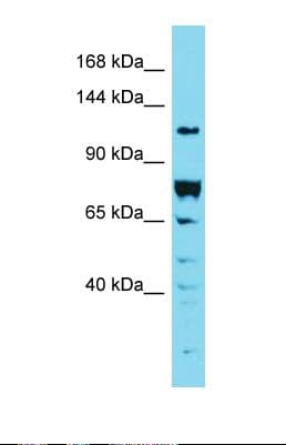 Polyclonal Rabbit anti-Human DENND2A / KIAA1277 Antibody (aa244-293, WB)