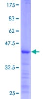 Human TGM1 / Transglutaminase Protein (Recombinant GST)