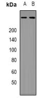 Polyclonal Rabbit anti-Human EP300 / p300 Antibody (Internal, IHC, WB)