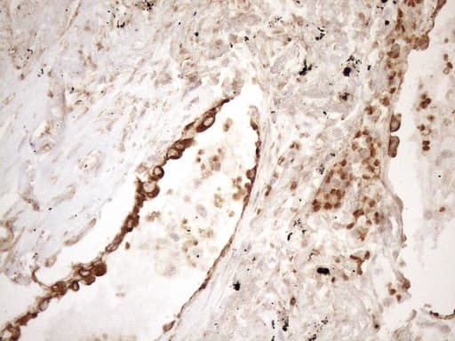 KRT16 / CK16 / Cytokeratin 16 Antibody (clone OTI1G1, Carrier-free)