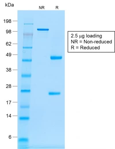 Recombinant Monoclonal Mouse anti-Human CD20 Antibody (clone rIGEL/773, Azide-free,Carrier-free, IHC, IF)
