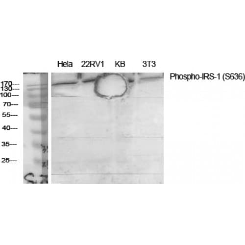 IRS1 Antibody (570-650 aa)