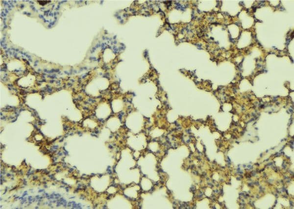 CHRNA1 Antibody