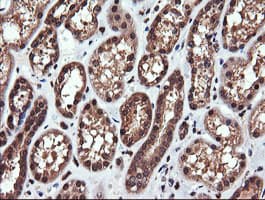 PIK3CG / PI3K Gamma Antibody (clone OTI6D1)