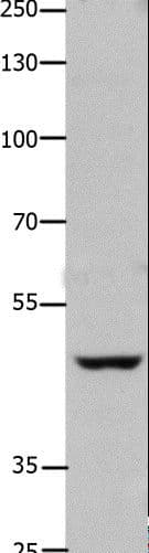 Polyclonal Rabbit anti-Human FOXD3 Antibody (WB)
