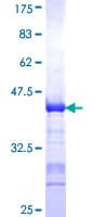 Human SCG2 / Secretogranin II Protein (Recombinant GST, N-terminus)