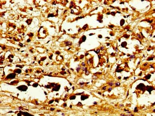 TUBD1 / Tubulin Delta Antibody