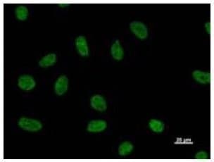 NUDT21 Antibody (clone 2203C3)