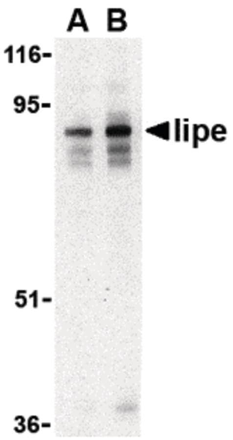 IHC-plus™ LIPE / HSL Antibody