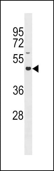 GXYLT2 Antibody (aa404-432)