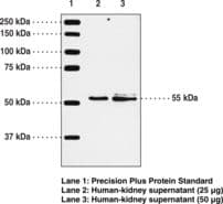 IHC-plus™ Polyclonal Rabbit anti-Human Leukotriene B4 Receptor / BLT1 Antibody (aa331-352, IHC, WB)