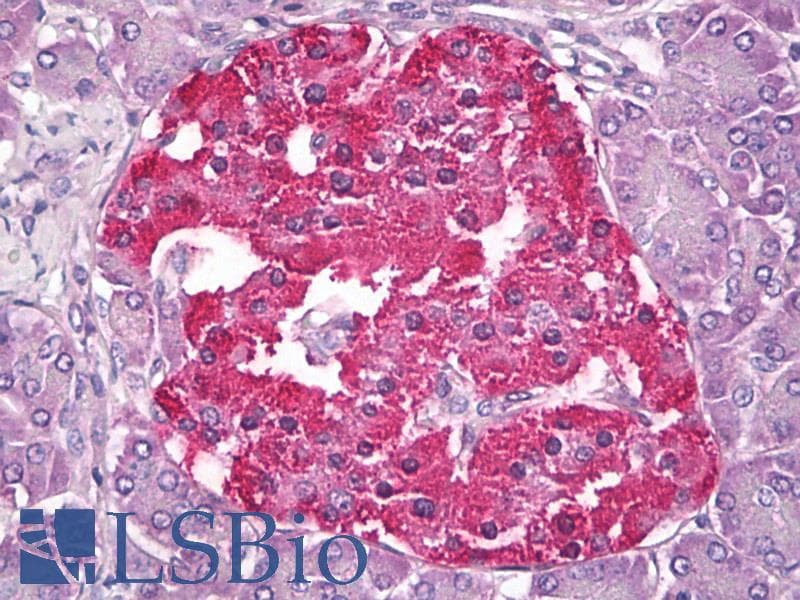 IHC-plus™ IGFBP5 Antibody