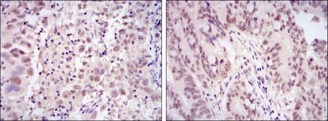 Monoclonal Mouse anti-Human CDK9 Antibody (clone 1B5D10, IHC, WB)