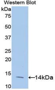 EIF4EBP1 / 4EBP1 Antibody (aa2-118)